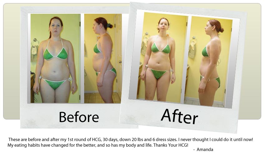 hcg diet customer hcg diet customer